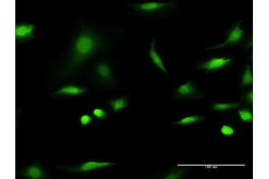 Immunofluorescence of monoclonal antibody to C1D on HeLa cell. (C1D antibody  (AA 1-141))