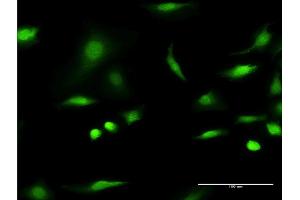Immunofluorescence (IF) image for anti-C1D Nuclear Receptor Corepressor (C1D) (AA 1-141) antibody (ABIN523839)