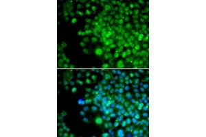 Immunofluorescence (IF) image for anti-Four and A Half LIM Domains 1 (FHL1) antibody (ABIN1876648) (FHL1 antibody)
