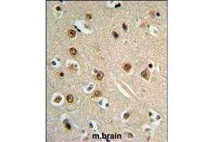 Immunohistochemistry (IHC) image for anti-gamma-aminobutyric Acid (GABA) A Receptor, alpha 4 (GABRA4) (AA 350-377) antibody (ABIN5536150)