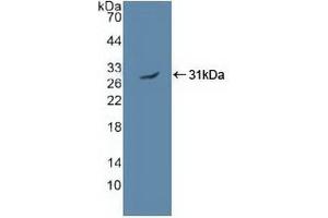 Detection of Recombinant PRKAa2, Human using Polyclonal Antibody to Protein Kinase, AMP Activated Alpha 2 (PRKAa2) (AMP Activated Protein Kinase Alpha2 (AA 252-493) antibody)