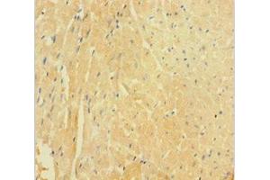 Immunohistochemistry of paraffin-embedded human heart tissue using ABIN7149501 at dilution of 1:100 (APPL1 antibody  (AA 214-495))
