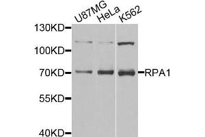 Western blot analysis of extracts of various cell lines,using RPA1 antibody. (RPA1 antibody)