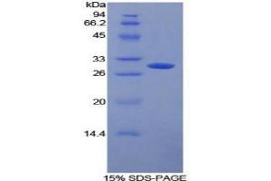 SDS-PAGE analysis of Human FcgRII Protein. (Fc gamma RII (CD32) Protein)