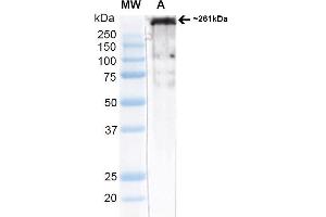 Western Blot analysis of Rat brain membrane lysate (native) showing detection of ~261 kDa Cav3. (CACNA1H antibody  (AA 1019-1293) (FITC))