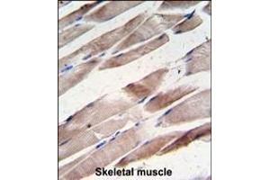 Immunohistochemistry (Paraffin-embedded Sections) (IHC (p)) image for anti-Desmin (DES) (AA 1-30) antibody (ABIN389226)