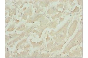 Immunohistochemistry of paraffin-embedded human heart tissue using ABIN7171567 at dilution of 1:100 (TBPL1 antibody  (AA 1-186))