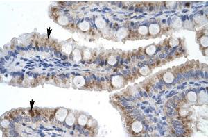 Human Intestine; Rabbit Anti-ZNF341 Antibody. (ZNF341 antibody  (Middle Region))