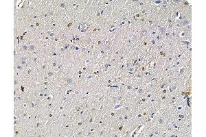 ABIN7096434 and ABIN7100498 at 1/100 staining rat brain tissue by IHC-P.