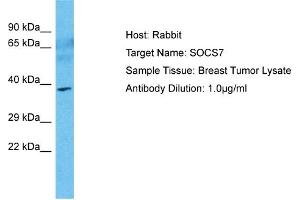 Host: Rabbit Target Name: SOCS7 Sample Type: Breast Tumor lysates Antibody Dilution: 1. (SOCS7 antibody  (N-Term))