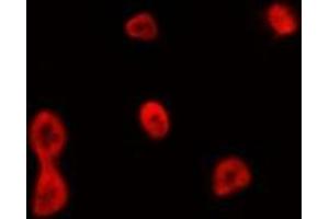 ABIN6275085 staining HepG2 by IF/ICC. (CCNB1IP1 antibody  (Internal Region))