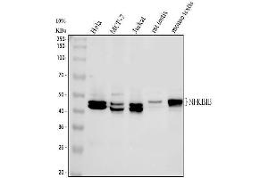Western blot analysis of IKB beta using anti-IKB beta antibody (ABIN3043567). (NFKBIB antibody  (AA 56-237))