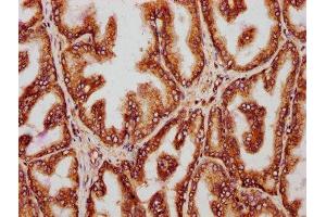 IHC image of ABIN7142103 diluted at 1:221 and staining in paraffin-embedded human prostate tissue performed on a Leica BondTM system. (14-3-3 theta antibody  (AA 1-245))