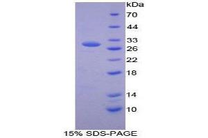 SDS-PAGE (SDS) image for Methionine Adenosyltransferase II, alpha (MAT2A) (AA 176-395) protein (His tag) (ABIN2125857)