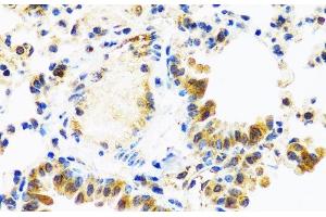 Immunohistochemistry of paraffin-embedded Mouse lung using C8orf4 Polyclonal Antibody at dilution of 1:100 (40x lens). (C8orf4 antibody)