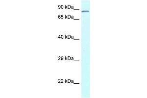 WB Suggested Anti-Cnot3 Antibody Titration: 1. (CNOT3 antibody  (N-Term))