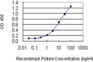 Detection limit for recombinant GST tagged STAM is 0. (STAM antibody  (AA 1-403))