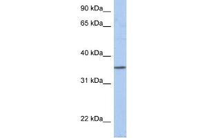 WB Suggested Anti-PRR18 Antibody Titration: 0. (Proline Rich 18 antibody  (N-Term))