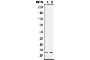 Western blot analysis of RIT1 expression in A549 (A), HeLa (B) whole cell lysates. (RIT1 antibody  (C-Term))
