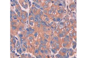 IHC-P analysis of Mouse Tissue, with DAB staining. (UCP1 antibody  (AA 179-296))