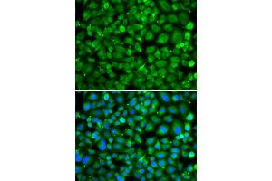 Immunofluorescence analysis of MCF-7 cells using SAT2 antibody. (SAT2 antibody)