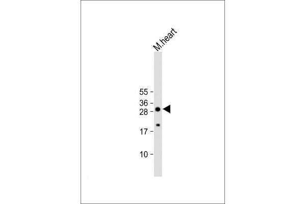 AQP11 anticorps  (C-Term)