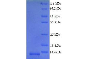 SDS-PAGE (SDS) image for Natriuretic Peptide Receptor B/guanylate Cyclase B (Atrionatriuretic Peptide Receptor B) (NPR2) (AA 22-106) protein (His tag) (ABIN5713490)