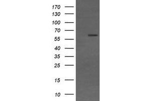 Image no. 2 for anti-CD19 Molecule (CD19) antibody (ABIN1497185) (CD19 antibody)