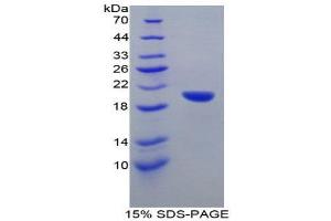 SDS-PAGE (SDS) image for Corin, Serine Peptidase (CORIN) (AA 334-477) protein (His tag) (ABIN1879800) (Corin Protein (AA 334-477) (His tag))