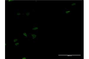 Immunofluorescence of monoclonal antibody to LEF1 on HeLa cell.