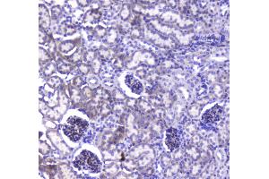 IHC analysis of VE Cadherin using anti-VE Cadherin antibody . (Cadherin 5 antibody  (AA 46-285))