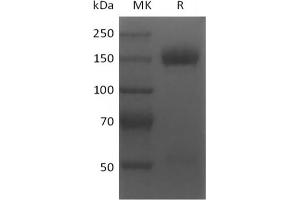 Western Blotting (WB) image for Tumor Necrosis Factor Receptor Superfamily, Member 17 (TNFRSF17) protein (ABIN7319817)