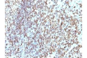 Immunohistochemistry (Formalin-fixed Paraffin-embedded Sections) (IHC (fp)) image for anti-Major Histocompatibility Complex, Class II, DR beta 1 (HLA-DRB1) antibody (ABIN3026892)