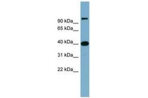 Image no. 1 for anti-Cyclin D-Type Binding-Protein 1 (CCNDBP1) (AA 179-228) antibody (ABIN6743832) (CCNDBP1 antibody  (AA 179-228))