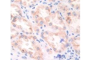 Used in DAB staining on fromalin fixed paraffin- embedded Kidney tissue (Fibronectin antibody  (AA 2206-2337))