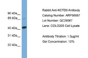 WB Suggested Anti-KCTD9  Antibody Titration: 0. (KCTD9 antibody  (Middle Region))