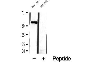 Western blot analysis of extracts of human testis tissue, using MLYCD antibody. (MLYCD antibody  (Internal Region))