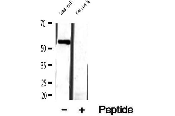 MLYCD antibody  (Internal Region)