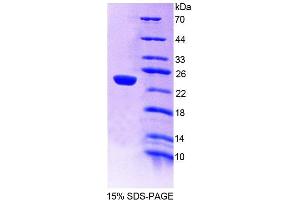 SDS-PAGE (SDS) image for Glucosidase, Alpha, Acid (GAA) (AA 70-245) protein (His tag) (ABIN6237680) (GAA Protein (AA 70-245) (His tag))