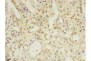 Immunohistochemistry of paraffin-embedded human adrenal gland tissue using ABIN7150209 at dilution of 1:100 (MSH6 antibody  (AA 1-400))