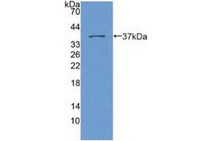 Figure. (SYNE2 antibody  (AA 6-296))