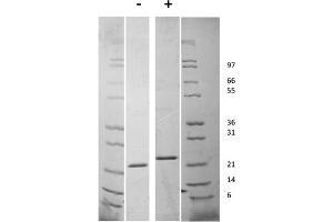 SDS-PAGE of Human Fibroblast Growth Factor-21 Recombinant Protein SDS-PAGE of Human Fibroblast Growth Factor-21 Recombinant Protein.