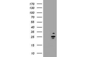 Image no. 1 for anti-RAB37, Member RAS Oncogene Family (RAB37) antibody (ABIN1500566) (RAB37 antibody)