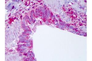 Anti-NLRP11 antibody IHC of human lung. (NLRP11 antibody  (C-Term))