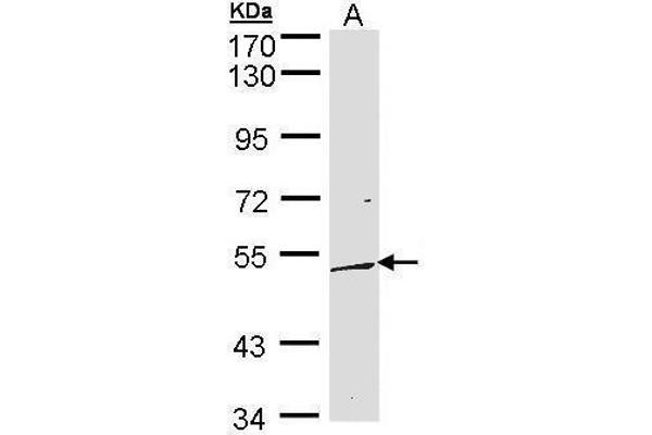 DUSP10 Antikörper  (C-Term)