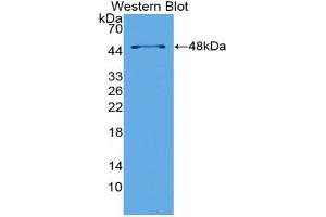 Detection of Recombinant LpPLA2, Mouse using Polyclonal Antibody to Phospholipase A2 Group VII (LpPLA2) (PLA2G7 antibody  (AA 22-440))