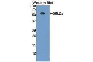 Western Blotting (WB) image for anti-CD46 (CD46) (AA 157-365) antibody (ABIN1859778) (CD46 antibody  (AA 157-365))