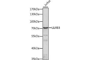 Western blot analysis of extracts of Jurkat cells, using LILRB3 antibody (ABIN7268239) at 1:1000 dilution. (LILRB3 antibody  (AA 400-500))
