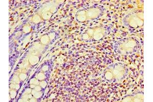 Immunohistochemistry of paraffin-embedded human colon tissue using ABIN7167365 at dilution of 1:100 (RAB6A antibody  (AA 2-208))