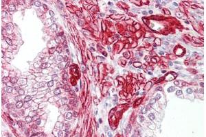 Anti-GAB2 antibody IHC staining of human prostate. (GAB2 antibody  (AA 125-174))